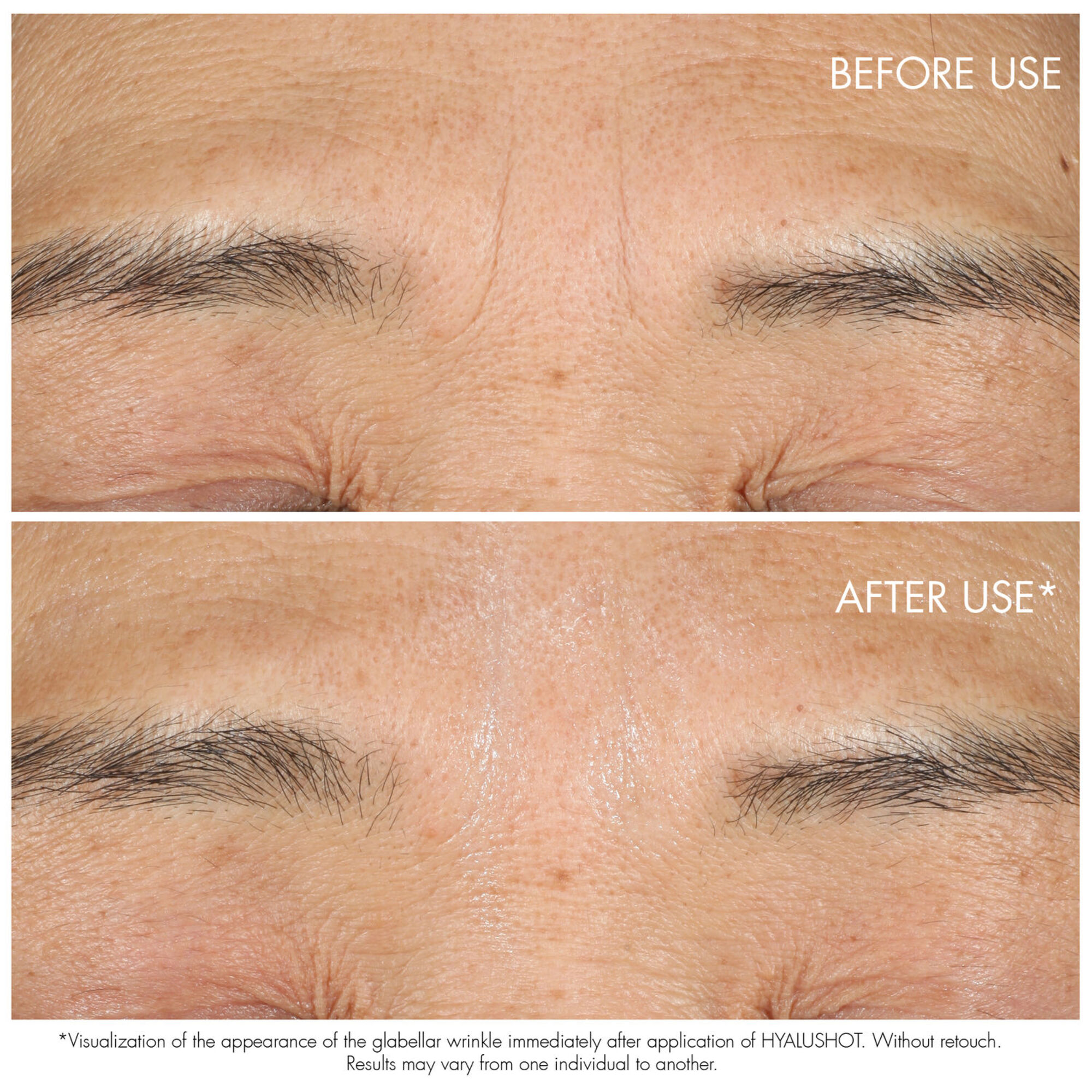 Pleťová kůra na obličej